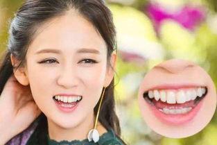 坏牙明星网红叫什么