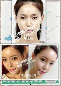 W 明星网红整形医院,塑造美丽传奇，引领时尚潮流