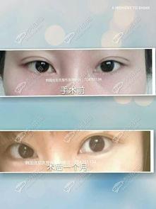 W 明星网红整形医院,塑造美丽传奇，引领时尚潮流